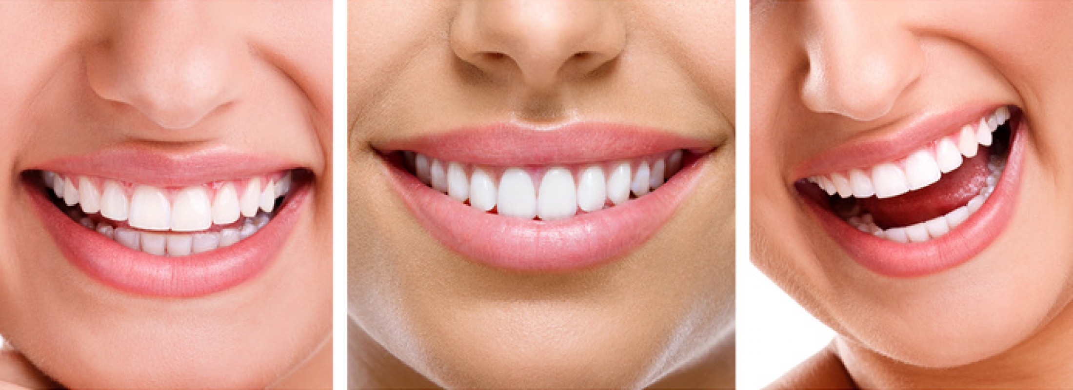Estética dental: qué piden los argentinos para sonreír mejor