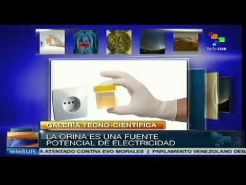 Tu orina se puede convertir en electricidad