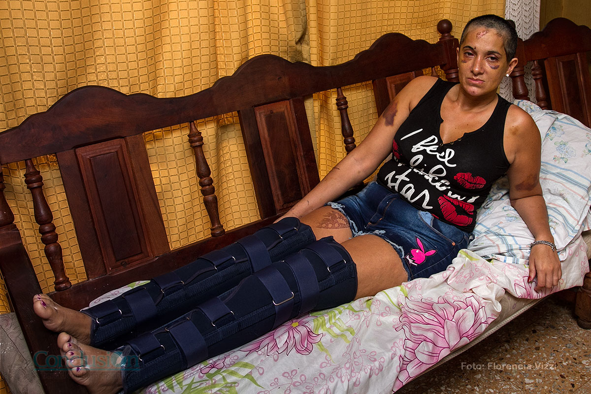 Colecta para ayudar a Lorena, víctima de violencia de género