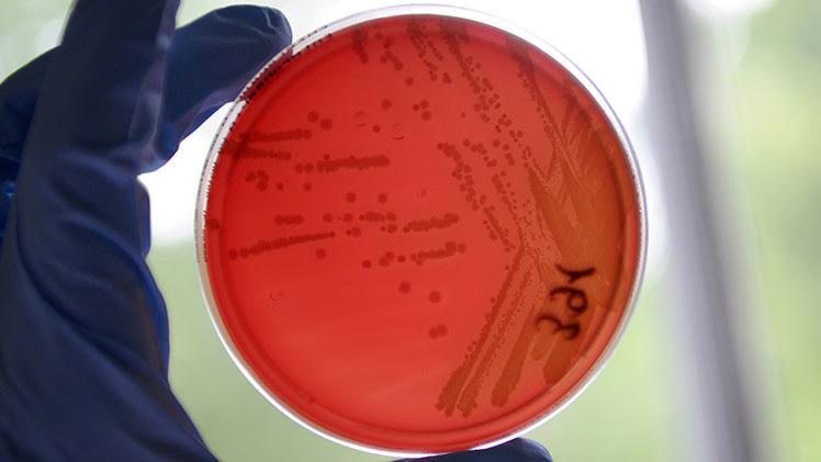 ¿Fuga de virus mortal de un laboratorio de Estados Unidos?