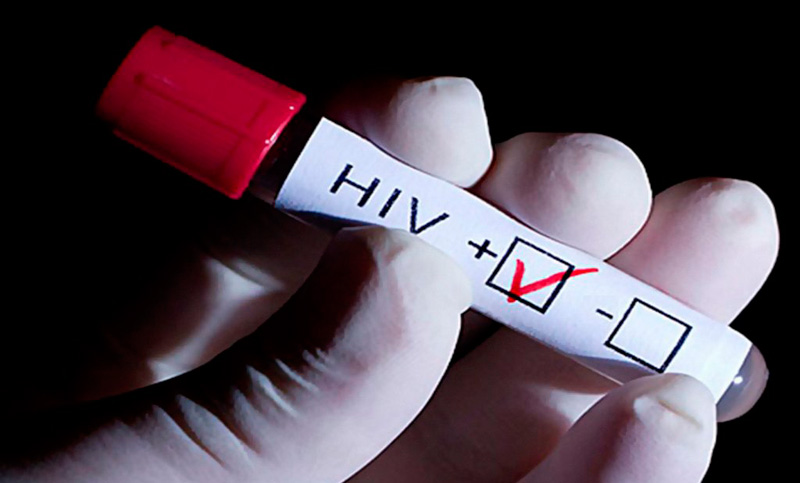 Sida: 2,5 millones de personas siguen infectándose cada año con VIH