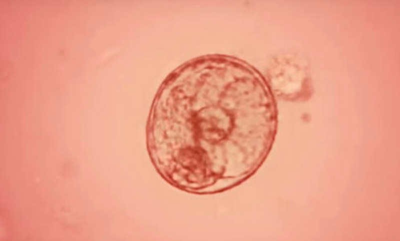 Avance sin precedentes: nació el primer bebé del mundo con  ADN de “tres padres genéticos”