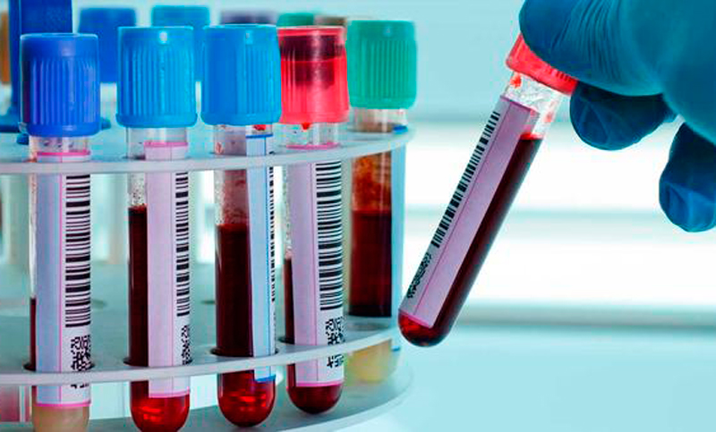 ¡SOS, hace falta un laboratorio para salvar vidas humanas!