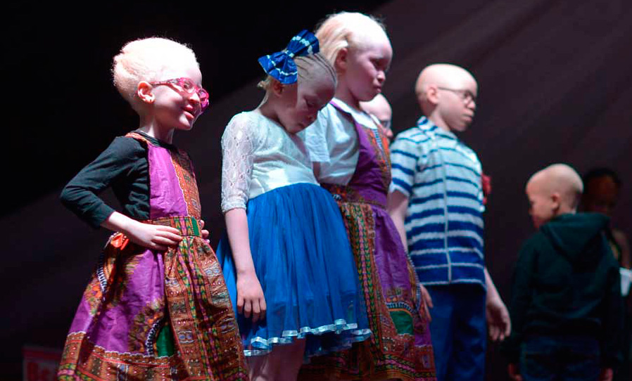 Un concurso de belleza de albinos para luchar contra los prejuicios