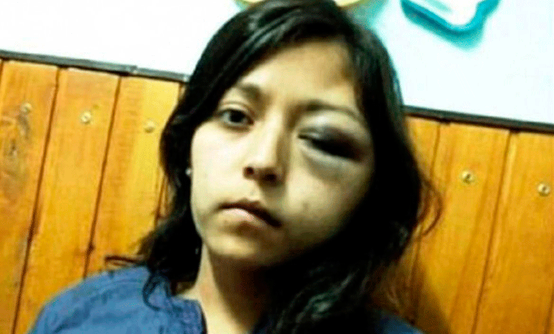 Nuevo caso de violencia de género: un militar desfiguró a golpes a su ex pareja