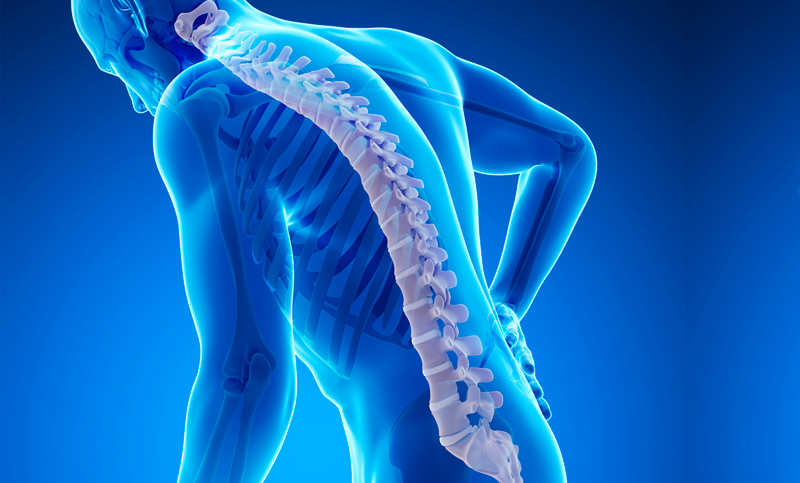 Osteoporosis: afecta a 1 cada 4 mujeres mayores de 50 años