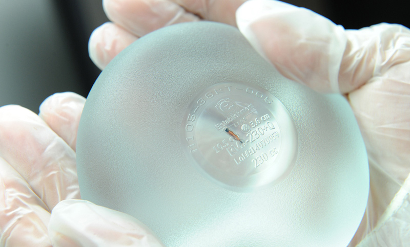 Realizan el primer implante mamario con chip en Argentina