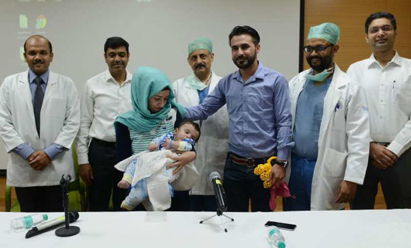 Un bebé con ocho brazos y piernas fue operado con éxito en India