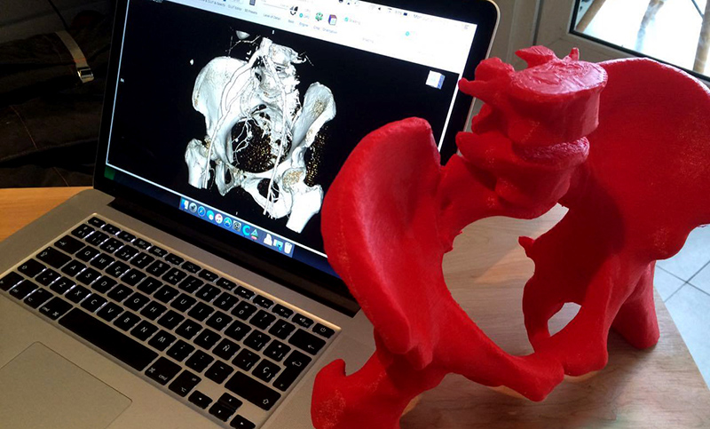 Tecnología 3D en Medicina, un proyecto argentino