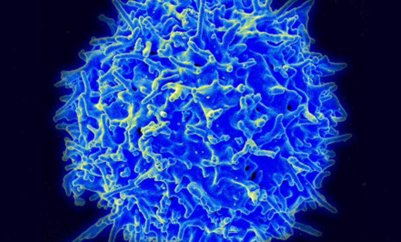 Un anticuerpo podría hacer que el sistema inmune mate células cancerosas