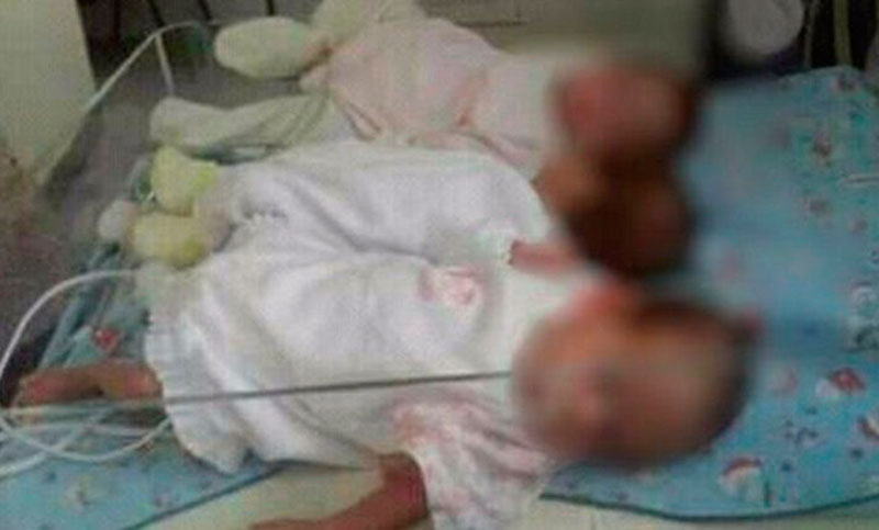 Trillizas recién nacidas fueron abandonadas y esperan una madre que las cuide