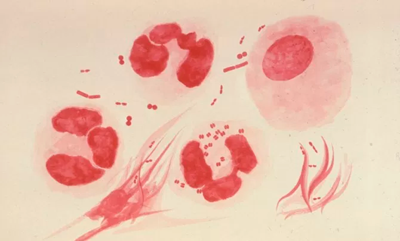 La gonorrea, cada vez “más inteligente y resistente a los antibióticos”
