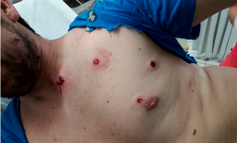 Brutal represión policial contra trabajadores de ATE en Neuquén deja heridos de gravedad