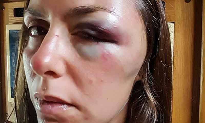Turista rosarina vivió “el peor día de su vida” al ser atacada en un cerro de Ecuador