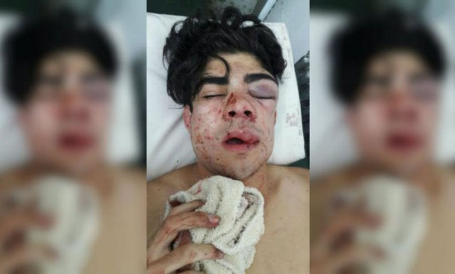 Cinco detenidos por golpear a un joven por tener «tonada chilena»