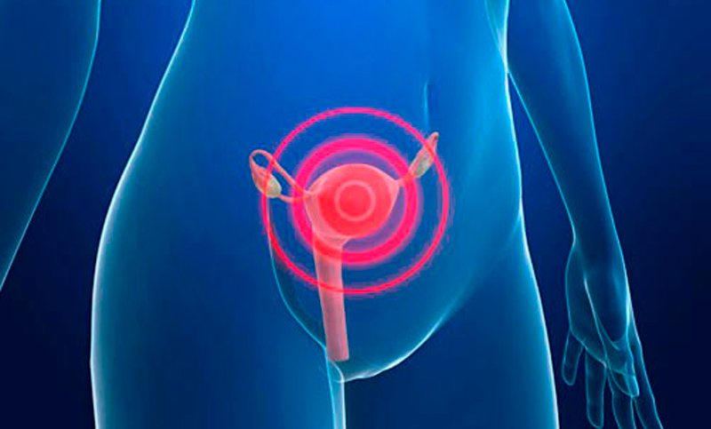 Se desarrollará un kit de detección para identificar el virus que causa el cáncer cervical