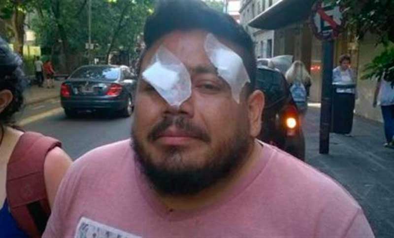 Docente perdió un ojo durante los incidentes frente al Congreso