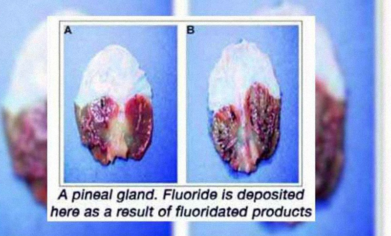 Un estudio muestra que el fluoruro convierte la glándula pineal en piedra