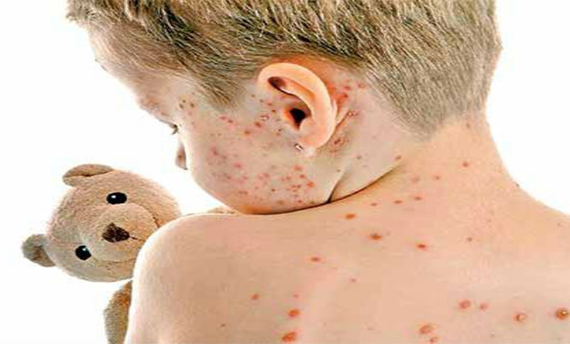 En la provincia ya se vacunaron 86 mil niños contra el sarampión y la rubéola