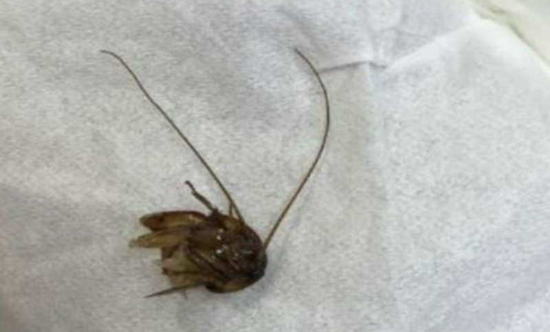 Una mujer vivió nueve días con una cucaracha en su oído