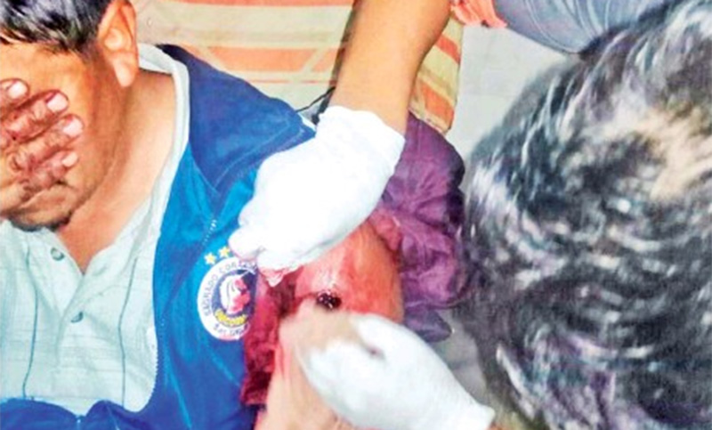 Un muerto y cuatro heridos en un tiroteo entre mineros en Bolivia