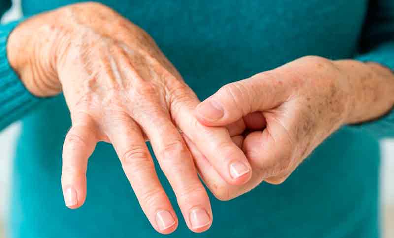 La Anmat prohibió unas cápsulas para paliar los síntomas de la artritis