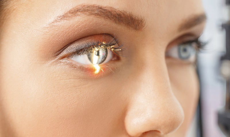 ¿Qué es el glaucoma?