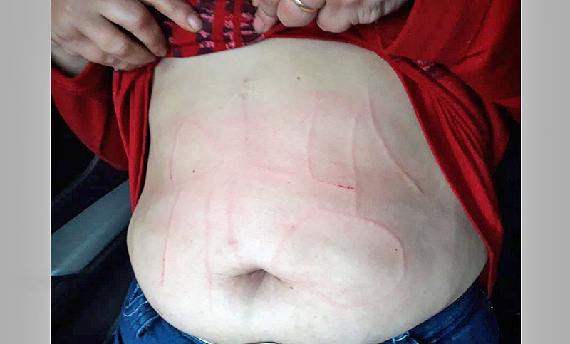 Torturaron a una maestra de Moreno escribiéndole el abdomen con un punzón