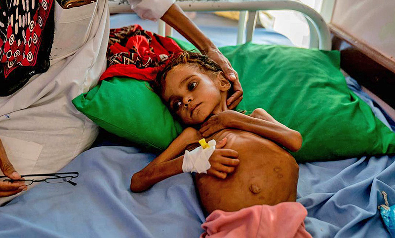 Murió Amal Hussain, la niña que expuso la miseria que deja la guerra en Yemen