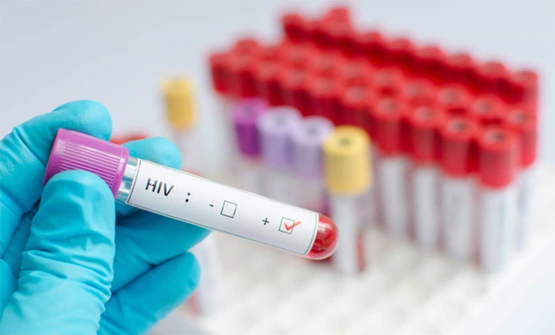 VIH: un estudio francés descubrió una fórmula que permite eliminar el virus