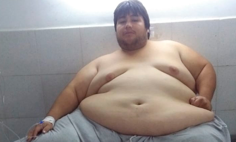 luciano-moreno-obesidad-m%C3%B3rbida-2.jpg