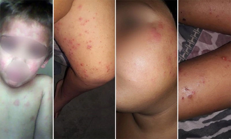 Por graves problemas de salud: ordenaron suspender la fumigación con agroquímicos en Pergamino