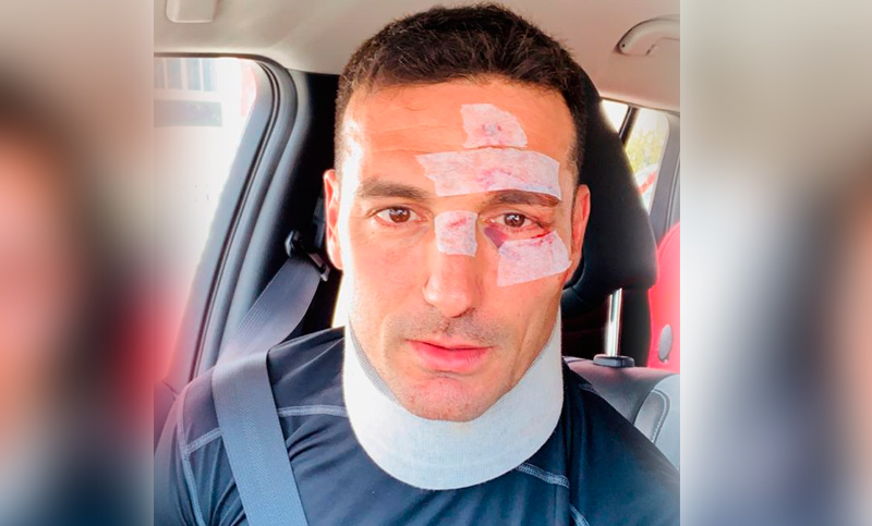 Atropellaron a Scaloni en Mallorca, estuvo internado y ya está fuera de peligro