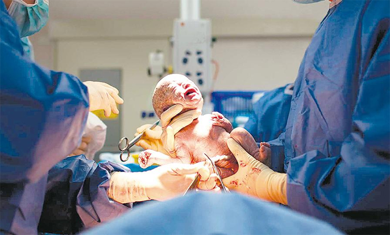 Las cesáreas marcan la hora del negocio médico