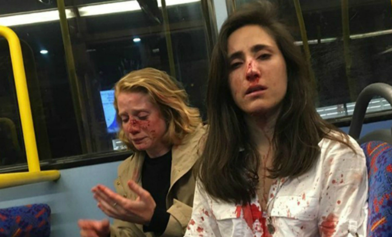 Ataque homofóbico en Inglaterra: dos mujeres fueron agredidas en un colectivo