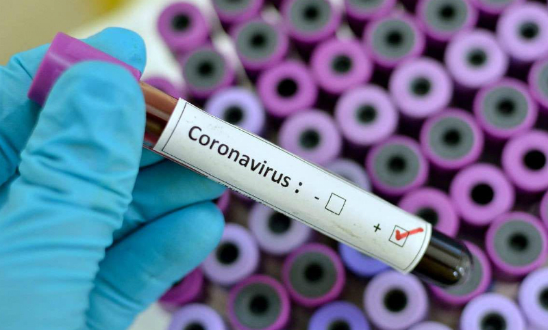 Suman 30 los casos de coronavirus en el país