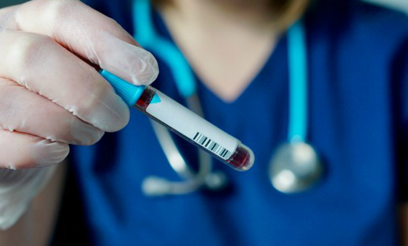 Diagnostican 32 casos nuevos de coronavirus en el país y la cuenta aumentó a 129