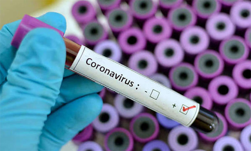 El día después de mañana: coronavirus, Latinoamérica y liderazgos hacia la cooperación