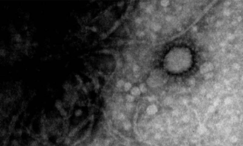 Científicos del Instituto Malbrán y el Conicet lograron fotografiar el coronavirus que circula en Argentina
