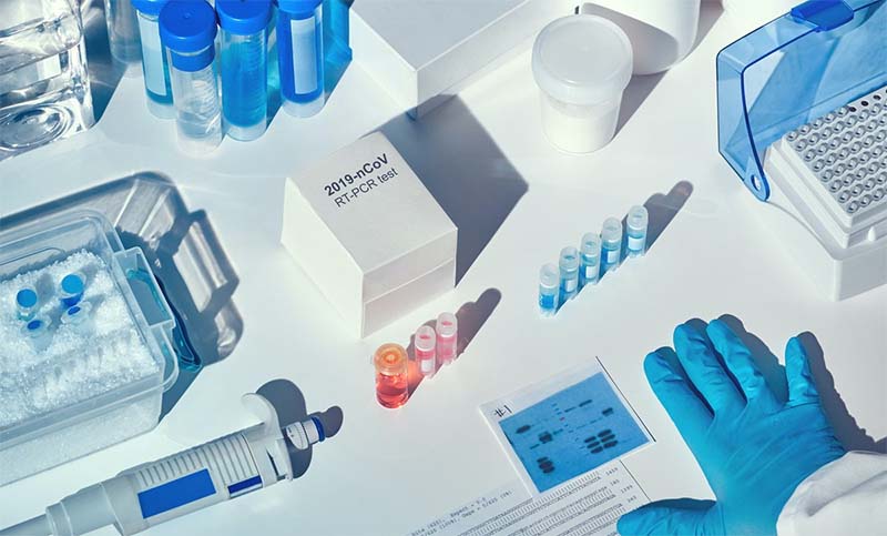 Coronavirus: Argentina recibió 250.000 test PCR para diagnóstico y confirmaron 167 muertes