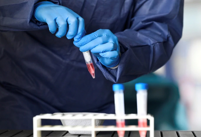 Ya se realizan más de 2.000 testeos de coronavirus por día en Argentina