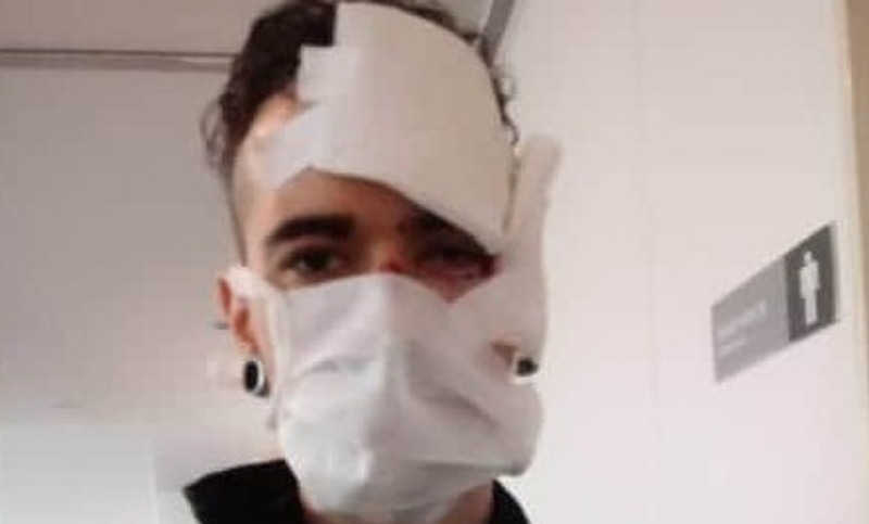 Brutal asalto a un repartidor de Rappi: lo dejaron inconsciente y le sacaron la bicicleta