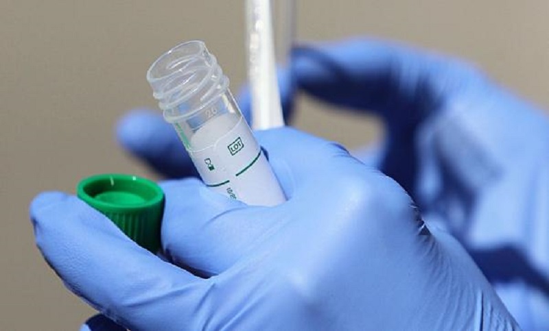 Un laboratorio de la UNR fue habilitado para realizar test de detección de coronavirus