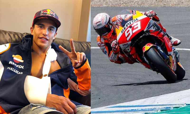 El español Márquez se fracturó el brazo en el MotoGP