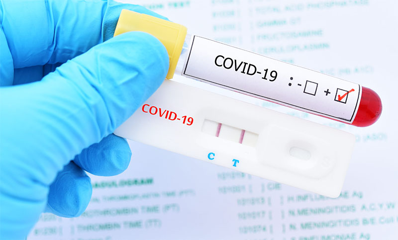 Quienes vivan con un infectado de coronavirus y tengan síntomas pueden ser diagnosticados sin testeo