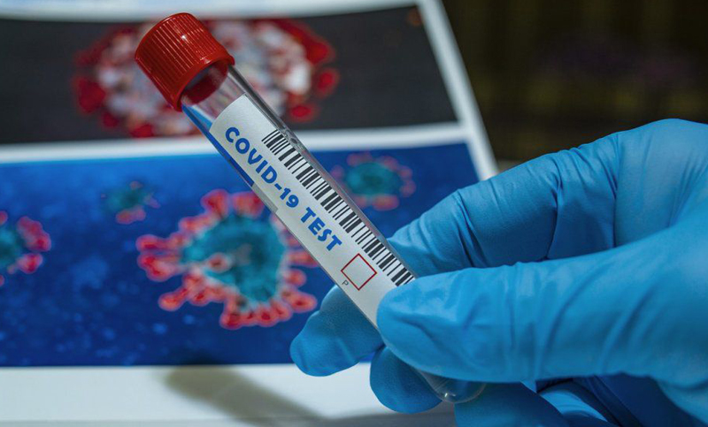 Otras 311 personas murieron y 7.164 fueron diagnosticadas con coronavirus en el país