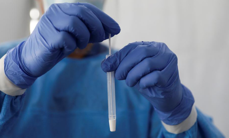 Reportaron 5.432 nuevos casos de coronavirus y 151 muertes en el país