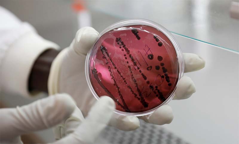 Nuevo virus letal similar al Ébola y se contagia de persona a persona enciende las alertas en Bolivia