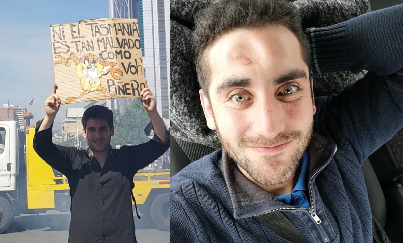 Volver a nacer: la historia de un joven chileno que esquivó la muerte en las protestas