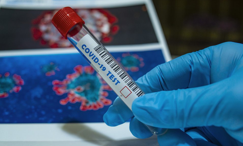 Otras 61 personas murieron y 3.658 contrajeron coronavirus en el país
